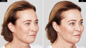 Relax Before And After