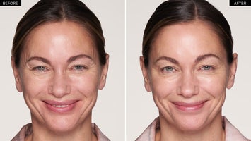 Relax Before And After