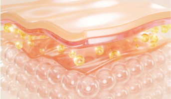 Specjalista Galderma Aesthetics aplikujący SHAPE UP™ HIT™ dla natychmiastowego efektu liftingu twarzy.