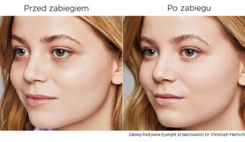 before-after